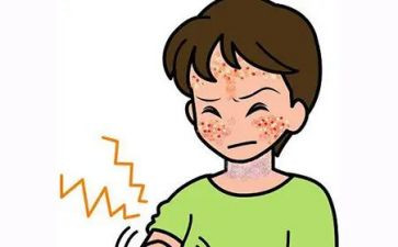 保护皮肤幼儿园教案5篇
